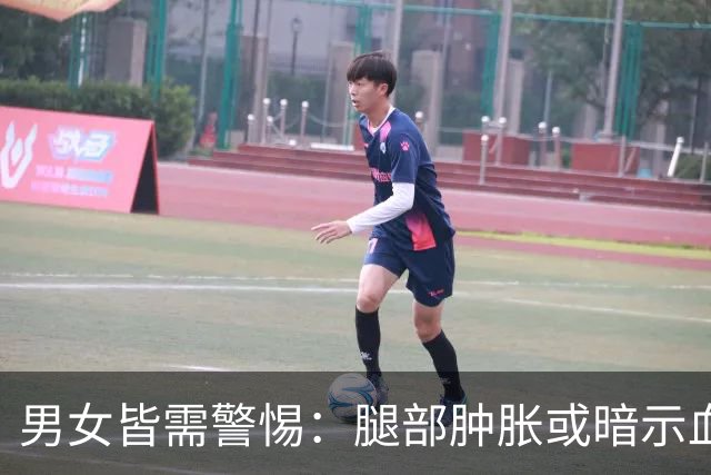 男女皆需警惕：腿部肿胀或暗示血栓风险